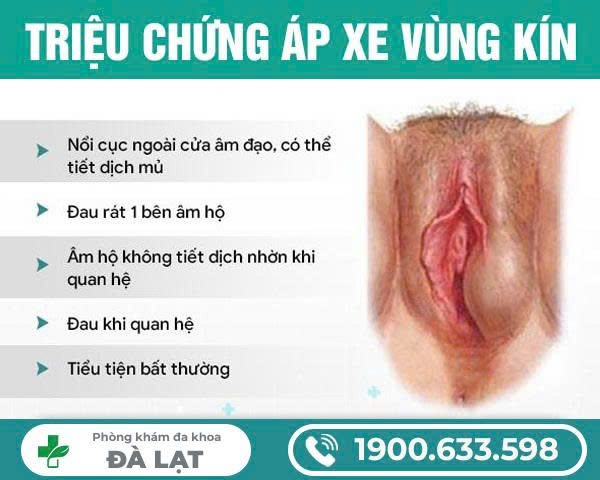 Hình ảnh minh họa